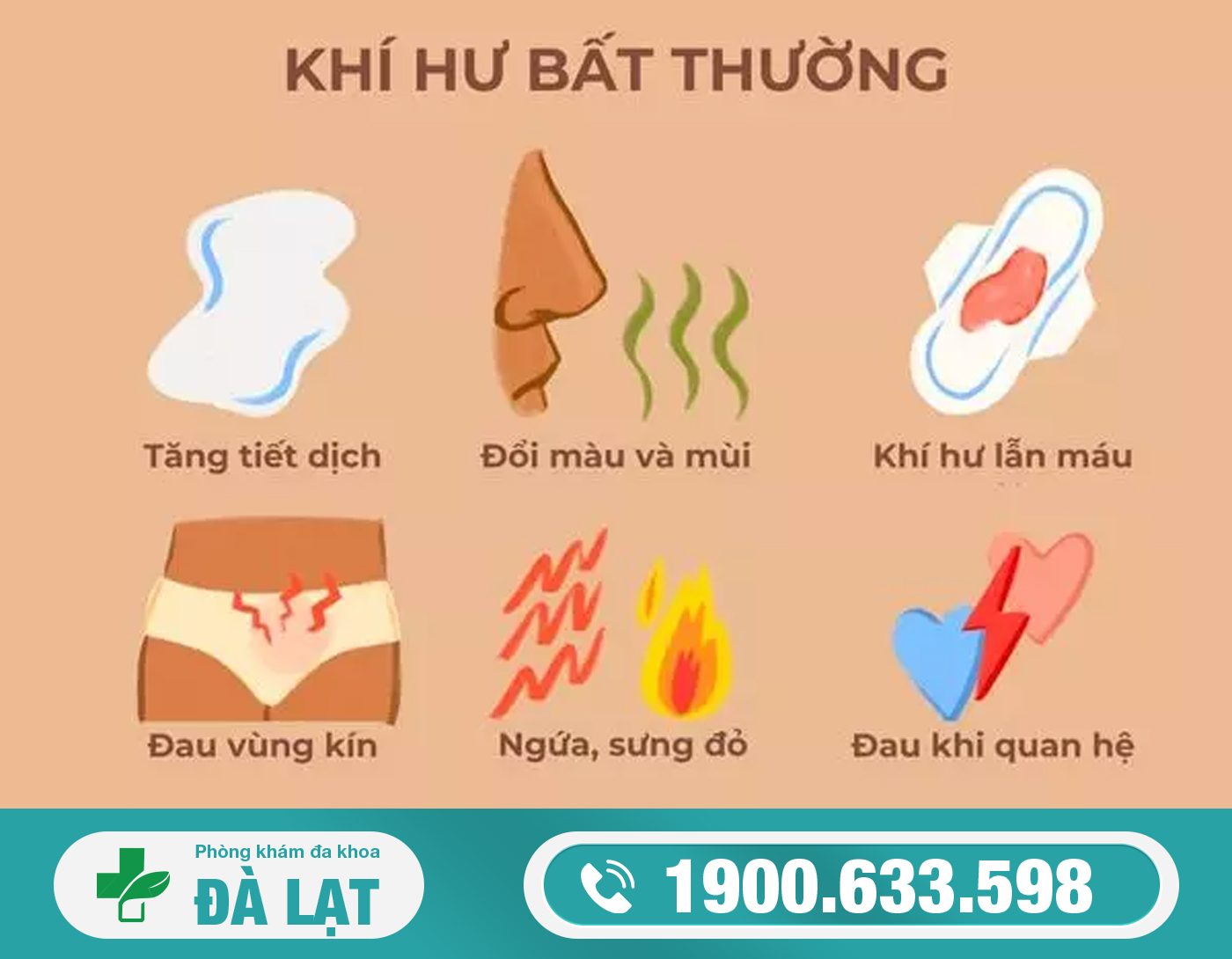 Hình ảnh minh họa